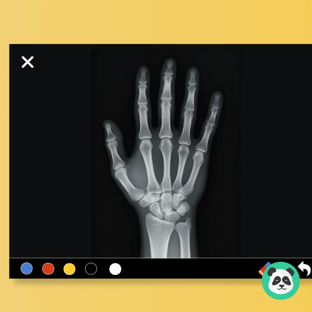 Interactive X-ray Medical Training